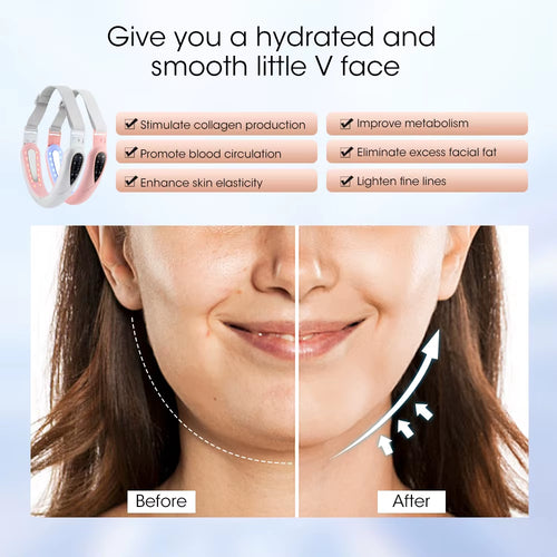FaceliftPro X™ – The Original V-Line Lifting Device | Now with Power Upgrade